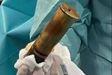 Homem com bomba no ânus dá entrada em hospital