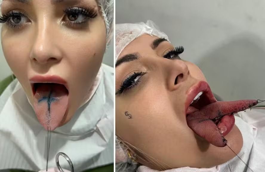 Andressa Urach faz bifurcação de língua para conteúdos adultos