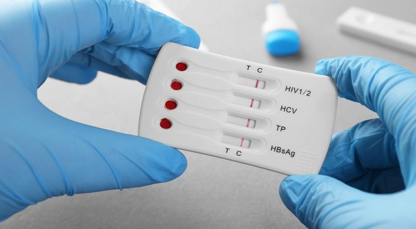 Nova Variante do HIV Identificada em Três Estados do Brasil