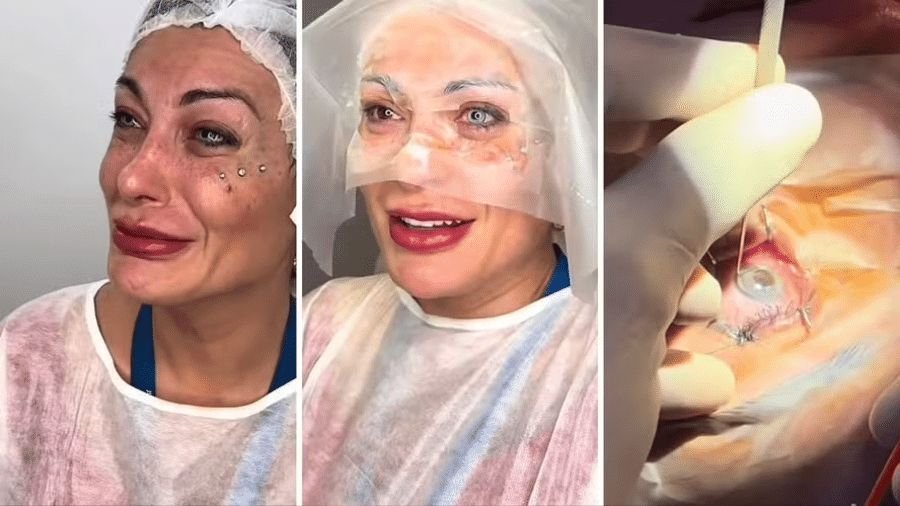 Andressa Urach muda cor dos olhos e se arrepende