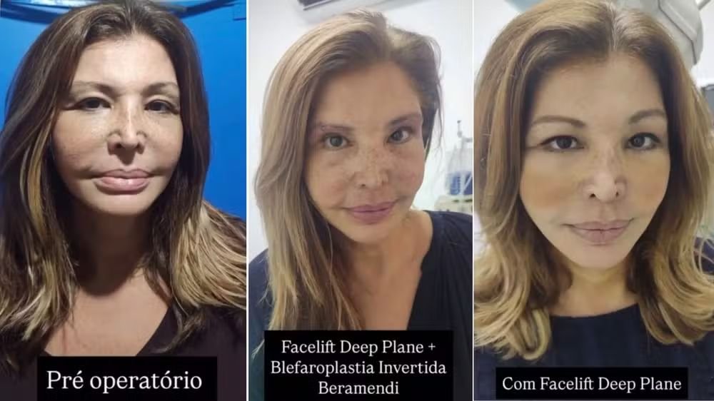 Roberta Close completa 61 anos e relembra trajetória